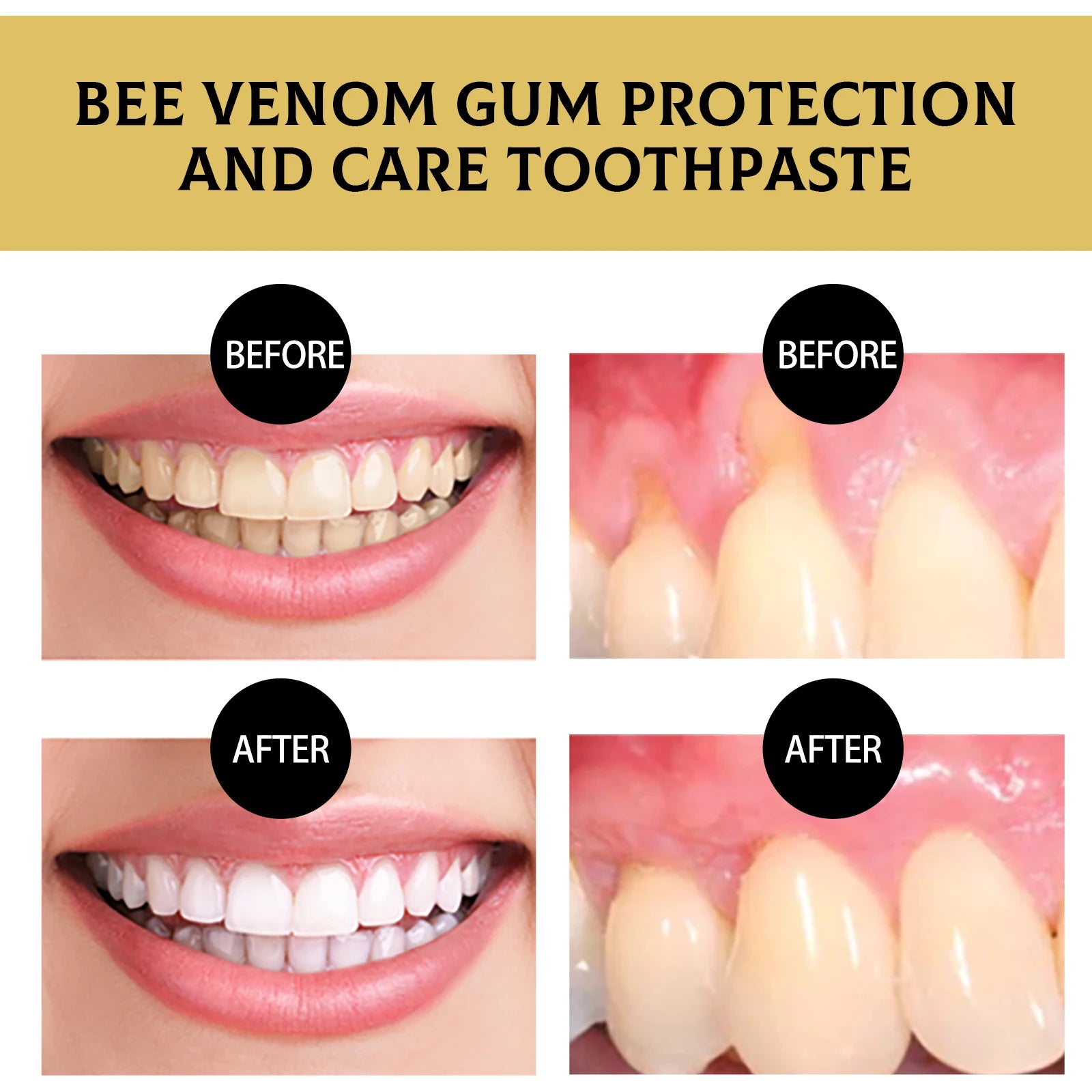 Bee Venom Gum Care Toothpaste Effectively Removes Yellow Teeth and Plaque Long-lasting Fresh Breath Gentle Oral Care Toothpaste