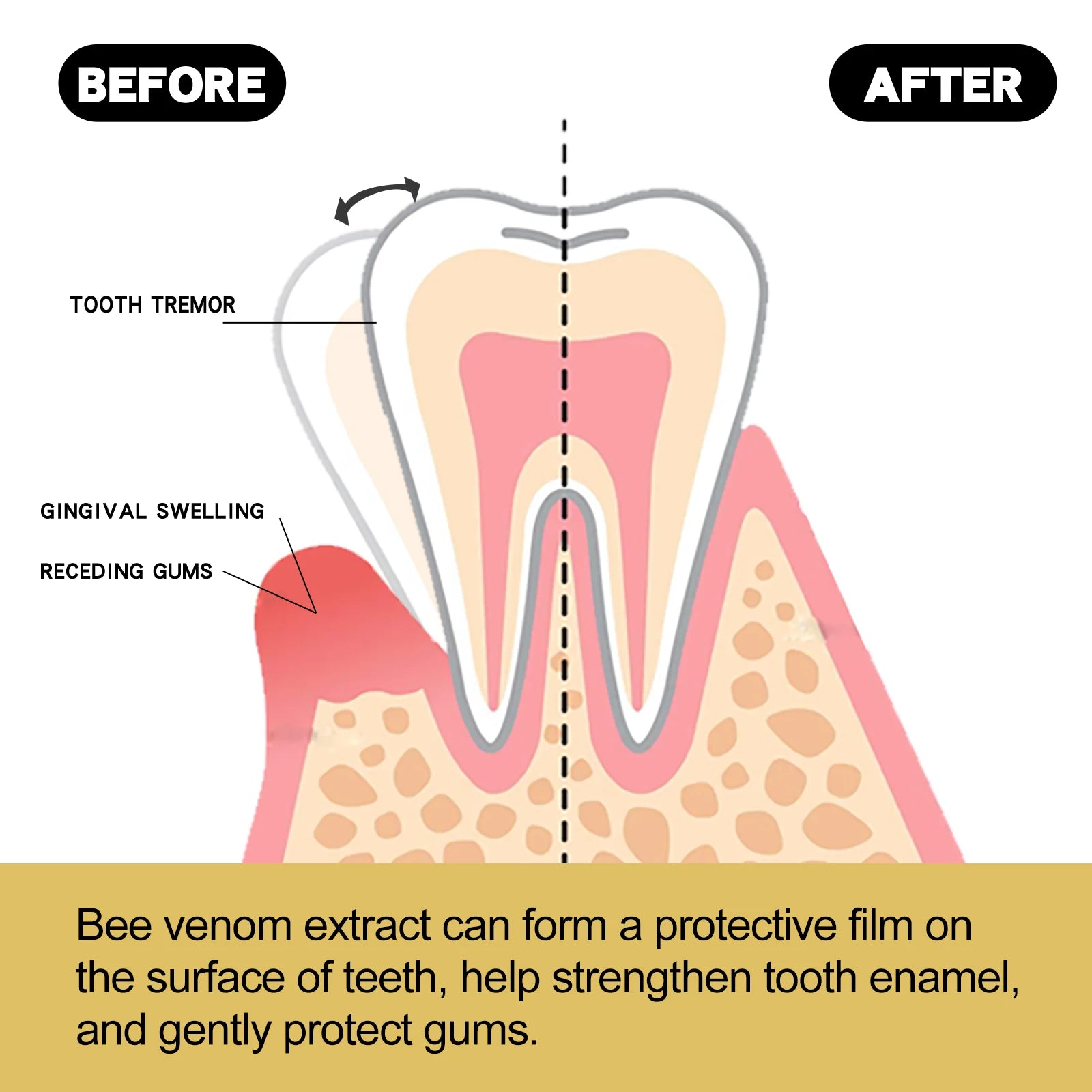 Bee Venom Gum Care Toothpaste Effectively Removes Yellow Teeth and Plaque Long-lasting Fresh Breath Gentle Oral Care Toothpaste