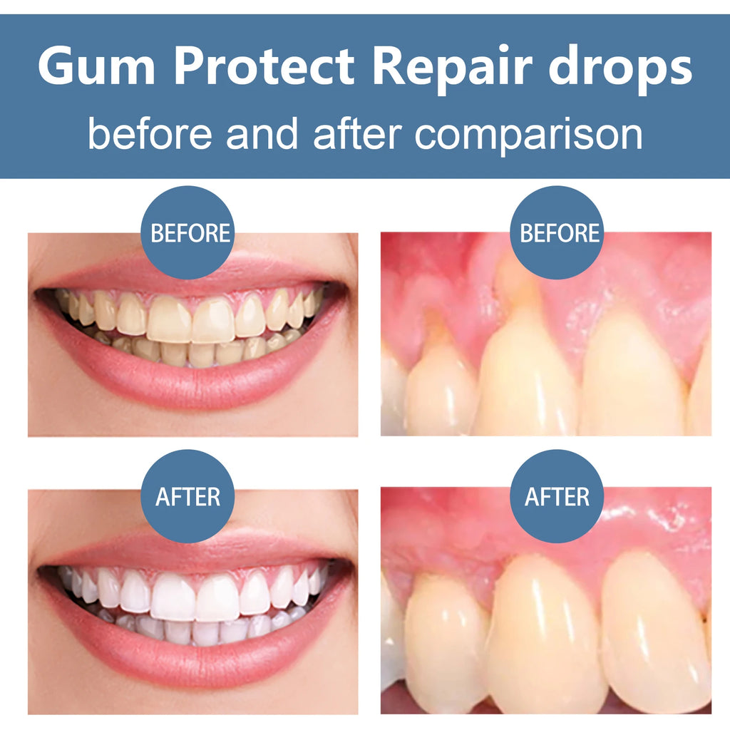 Rapid Repair Gums Serum Effectively Relieve Tooth Allergy Dental Caries Tooth Cleaning Toothpaste Relieve Tooth Damage Drops