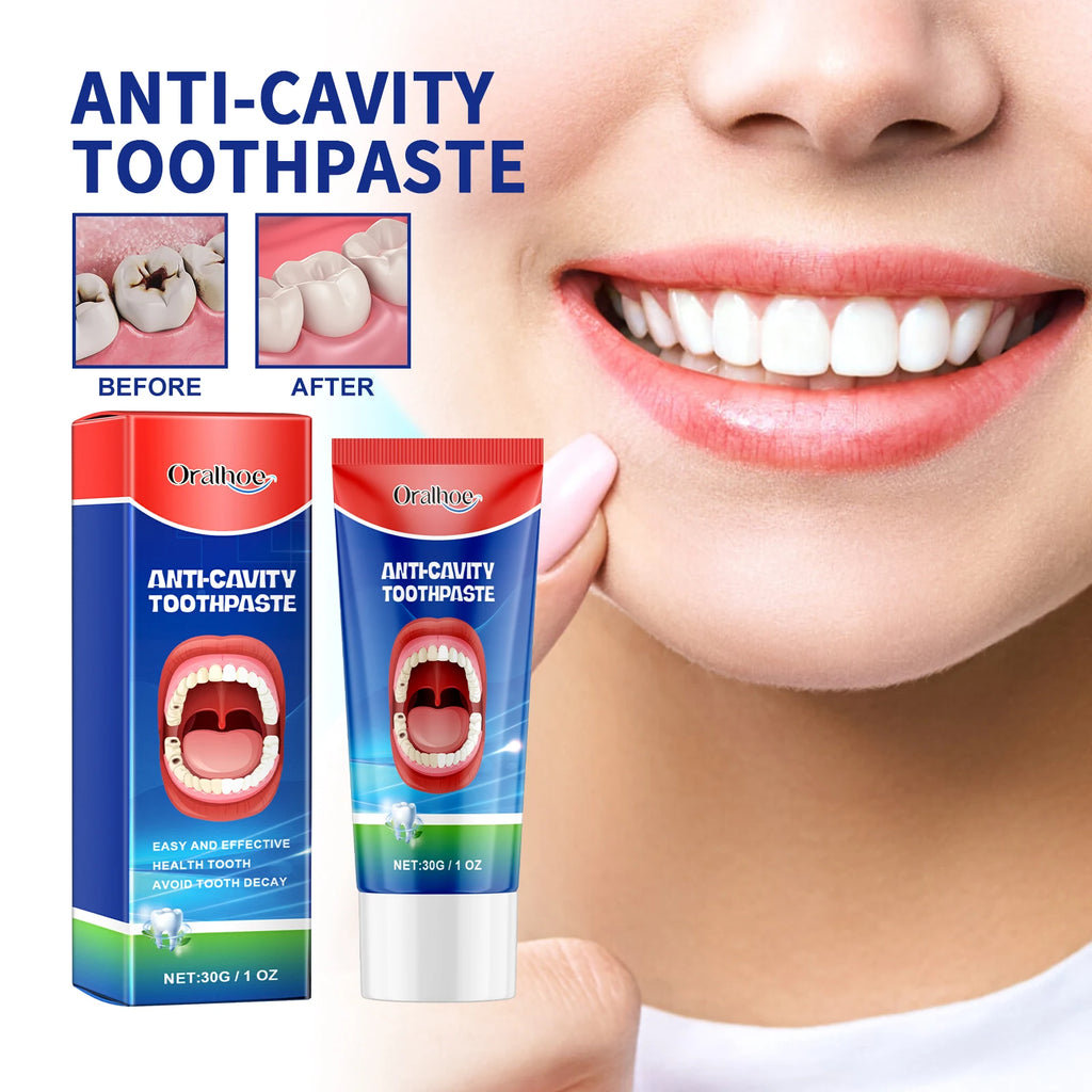 Anti Decay Toothpaste Dental Caries Repair Cream Prevent Tooth Decay Protect TeethDeep Clean Whitening & Fresh Breath Toothpast