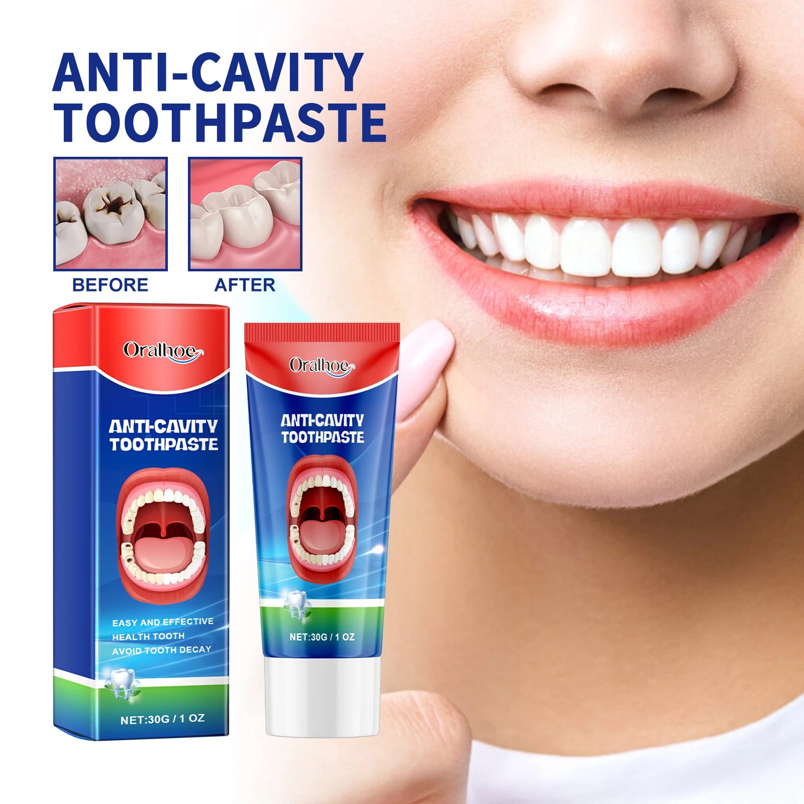 Anti Decay Toothpaste Dental Caries Repair Cream Prevent Tooth Decay Protect TeethDeep Clean Whitening & Fresh Breath Toothpast