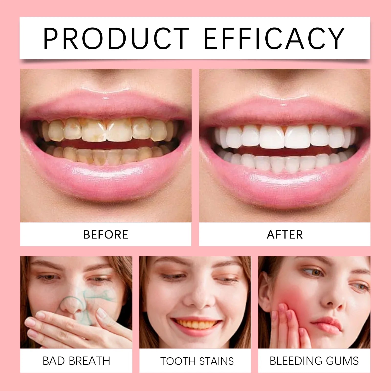 Sp10 Probiotic Toothpaste Deep Cleaning Remove Plaque Improve Dental Caries Protect Gum Fresh Breath Oral Hygiene Cleansing 120g