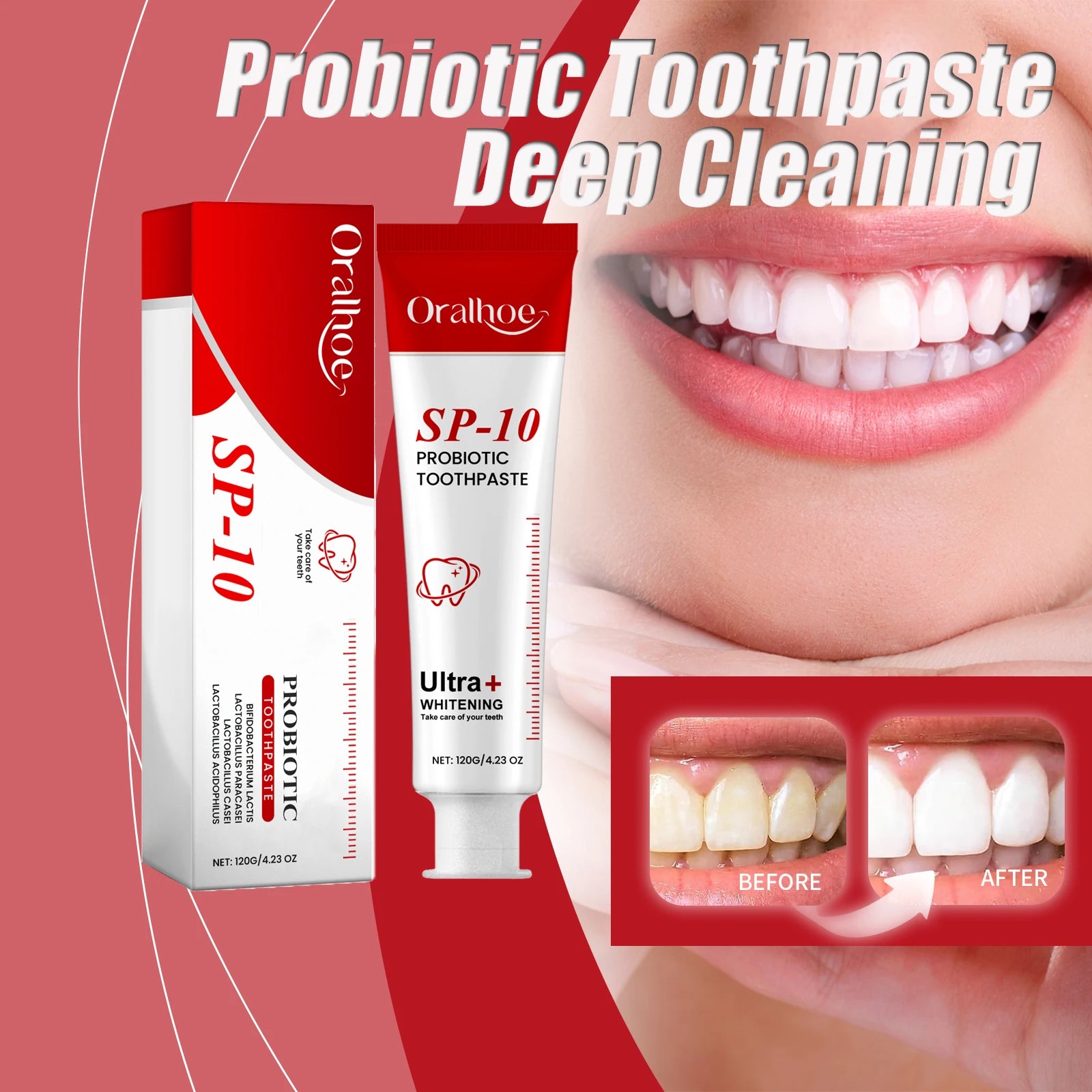Sp10 Probiotic Toothpaste Deep Cleaning Remove Plaque Improve Dental Caries Protect Gum Fresh Breath Oral Hygiene Cleansing 120g