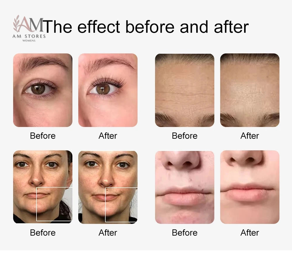 AM Stores 10-in-1 aqua peel and oxygen facial system